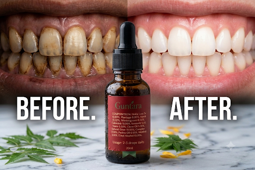 Guntara Ayurvedic Dental Lotion (20ml) – Gum Swelling, Pyorrhea & Teeth Whitening |(Pack of 2)